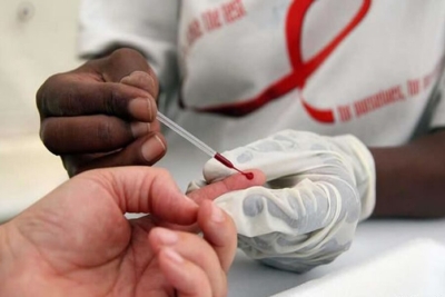 Cerca de 38 mil pessoas morreram por HIV/SIDA em 2020 no país