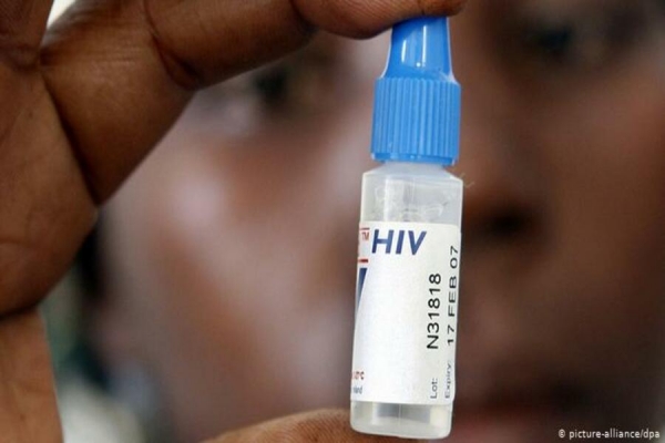 Falta de fundos condiciona luta contra o HIV/SIDA em Moçambique